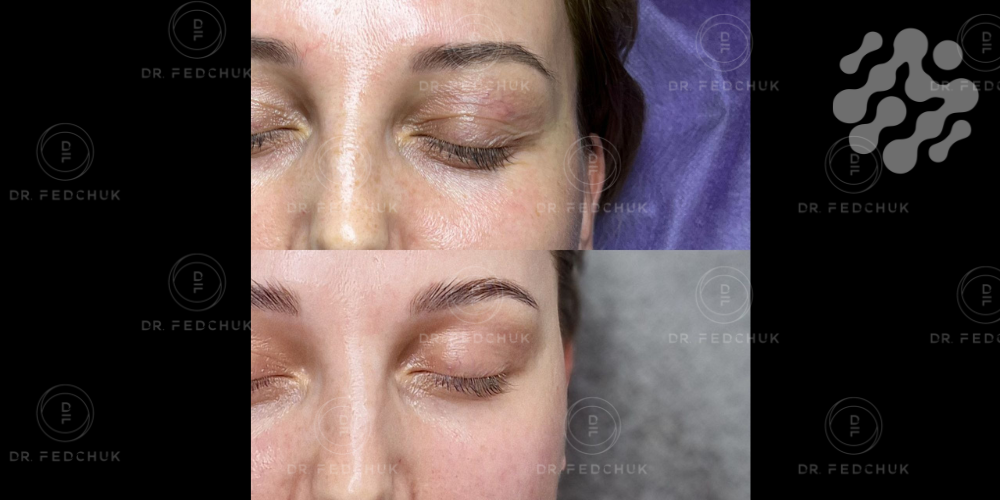 1-Mar-05-2025-10-04-24-9371-AM