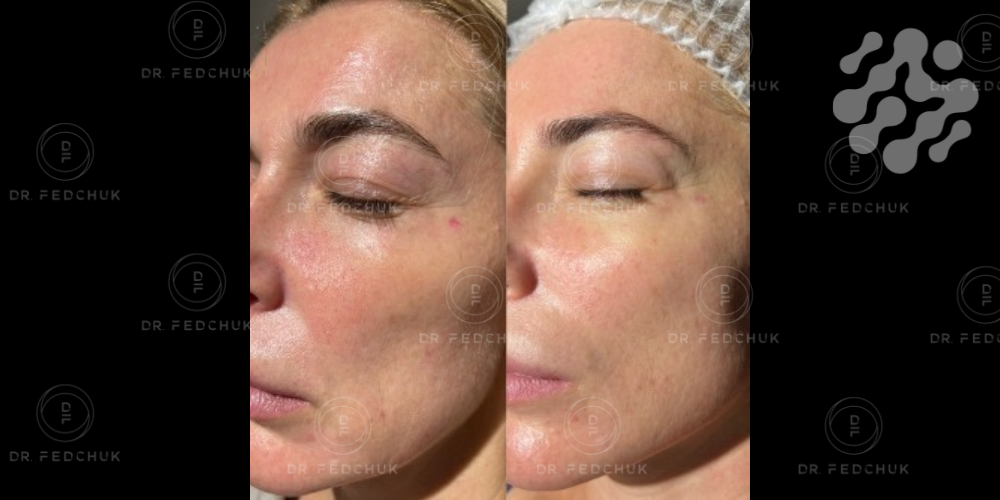 2-Mar-05-2025-10-04-22-3691-AM