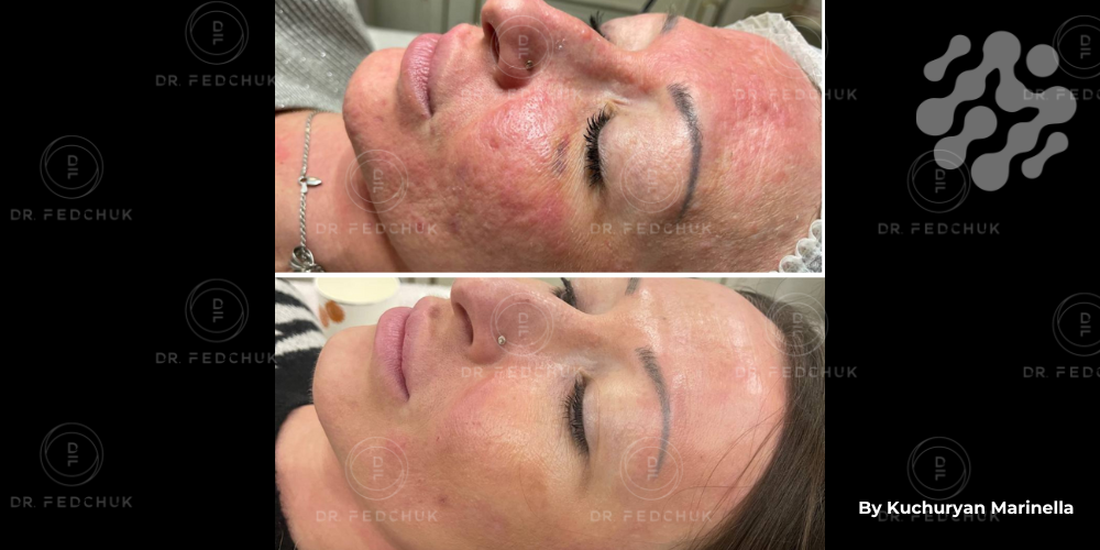 3-Mar-05-2025-10-04-22-3149-AM