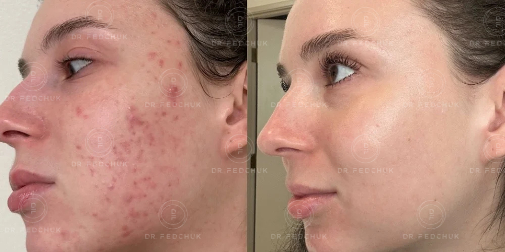 5-Mar-05-2025-10-04-22-5946-AM